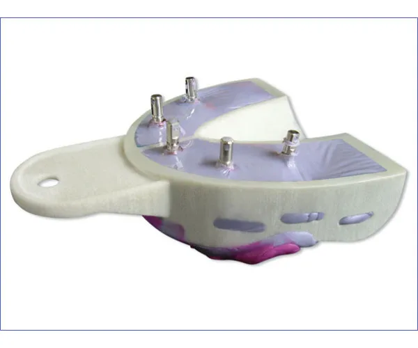 MIRATRAY Implant SET набір ложок імплантологічних асорті 6 шт Miradent (Німеччина)